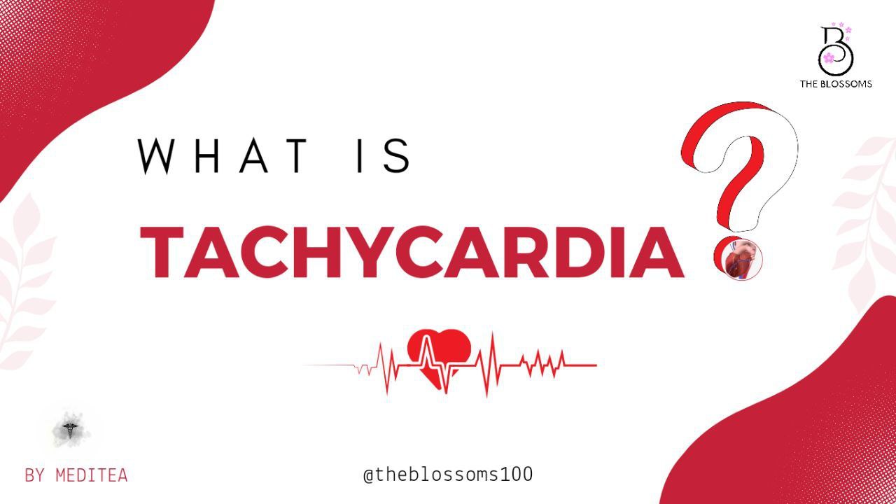 What is Tachycardia?