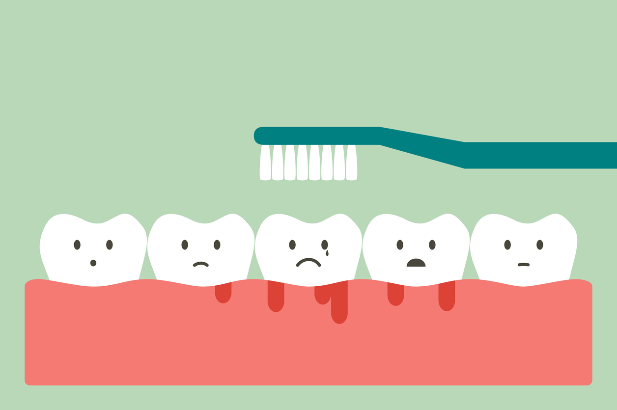 all about bleeding gums